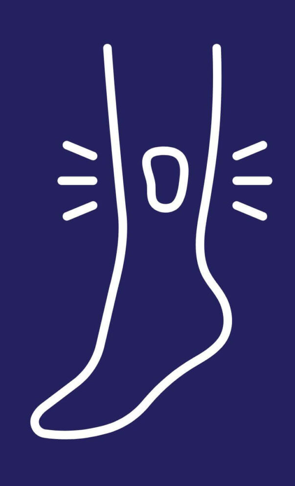 Treating Venous Stasis Ulcers | Advanced Wound Care